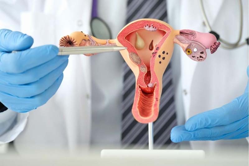 Janeiro Verde: ginecologista alerta para sintomas, prevenção e tratamento do câncer de colo de útero