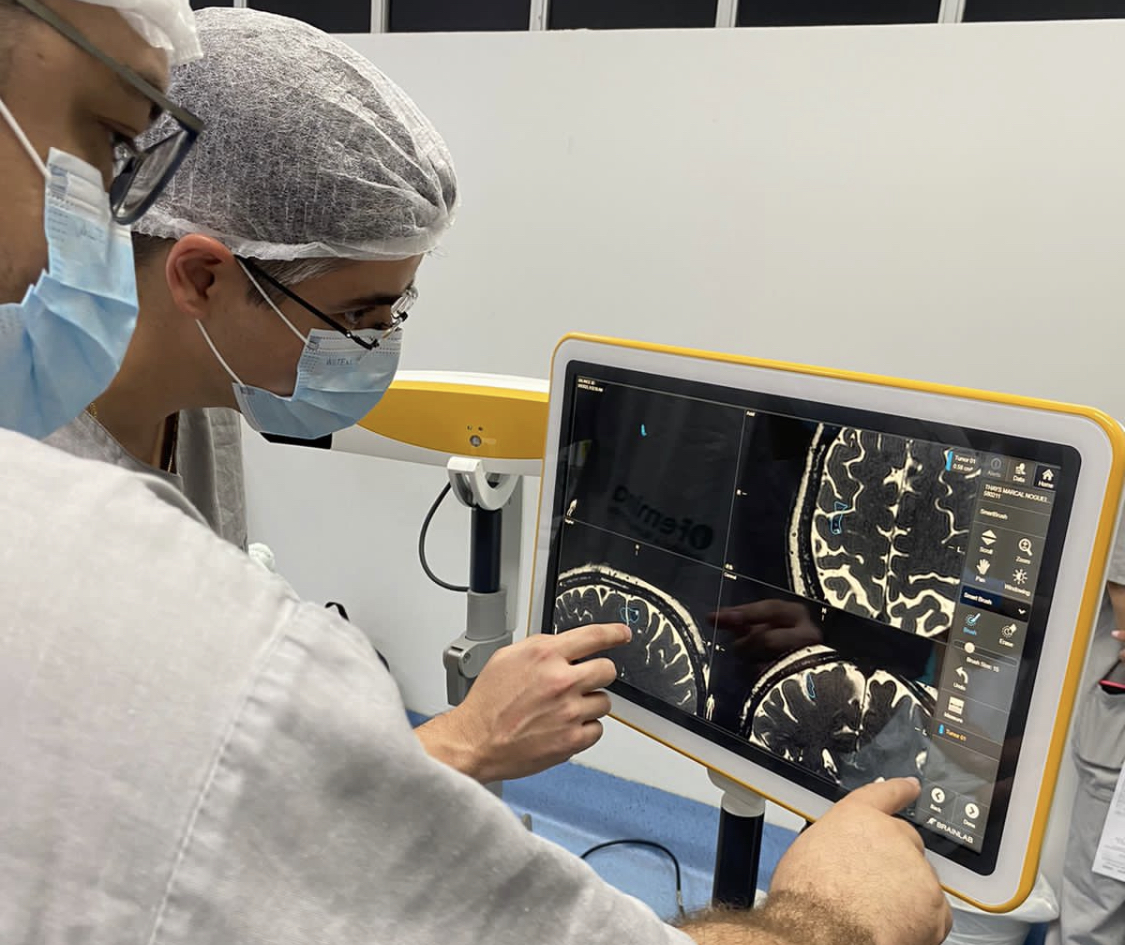 Hospital Femina realiza microcirurgia de tumor cerebral com tecnologia de neuronavegação