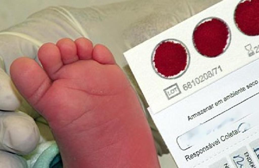 Teste do Pezinho completa 50 anos e reforça importância do diagnóstico precoce em recém-nascidos